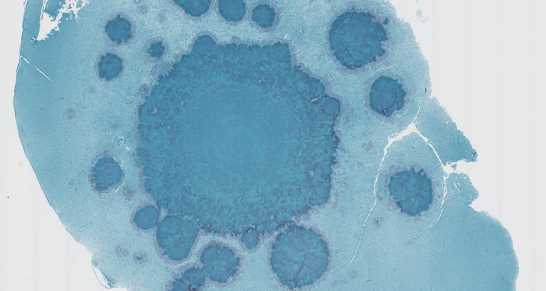 Image of a blue stain created by a cross section of a duck's brain.