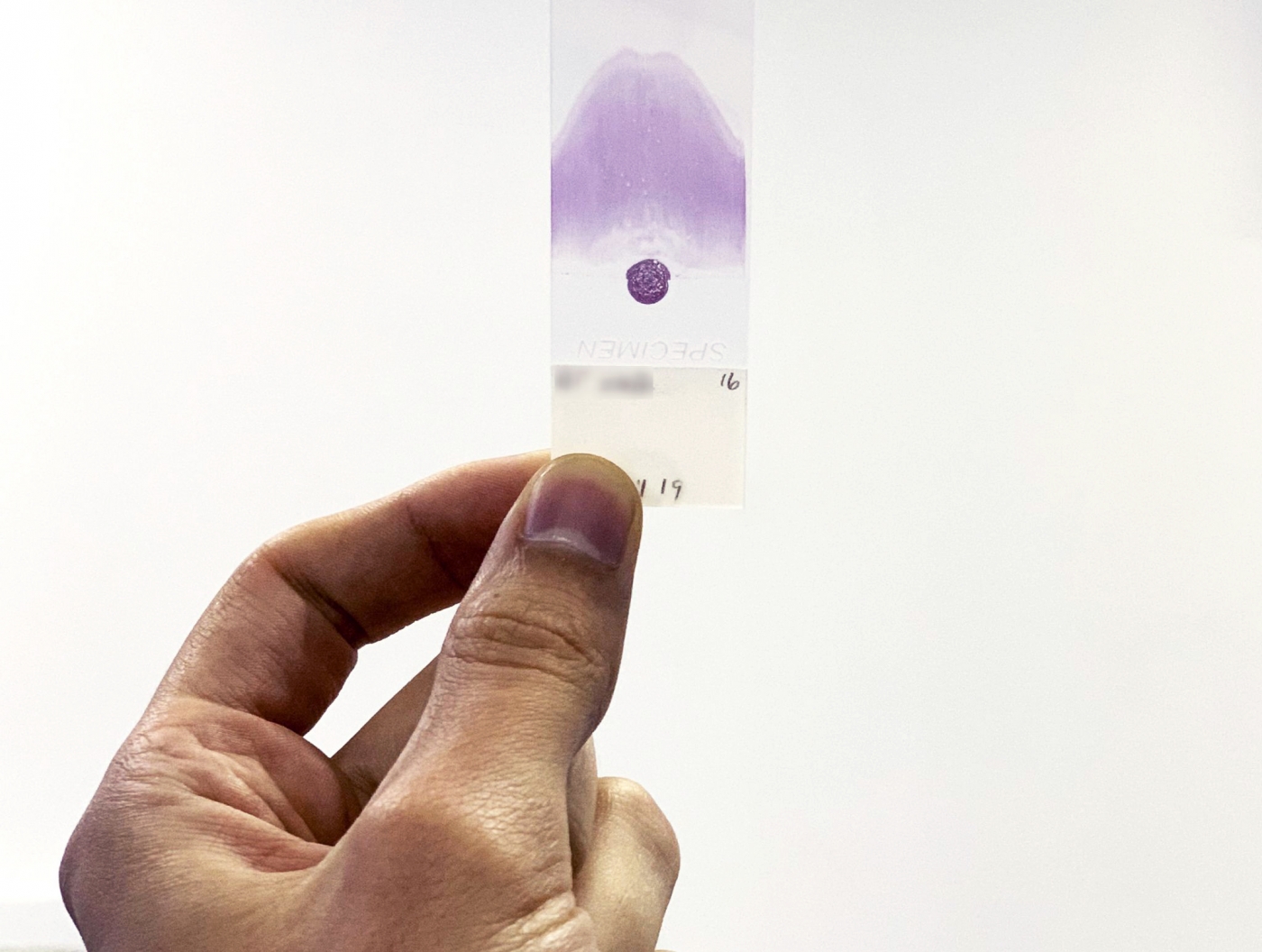 A veterinarian holding a slide with a single drop of blood.