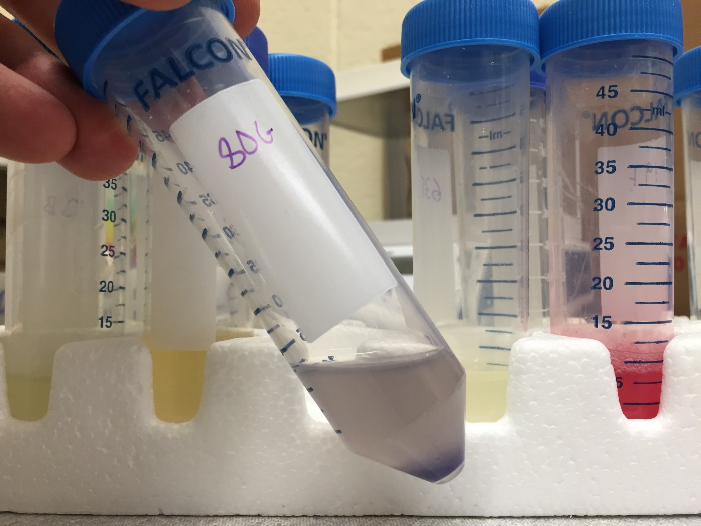 A cocktail of anti-fungal bacteria in a test tube.