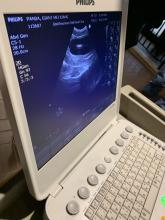 An ultrasound shows giant panda Mei Xiang's uterus. A ultrasound image of a giant panda's uterus