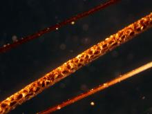 The African crested rat sequesters poisons from Acokanthera schimperi into specialized hairs, shown here alongside typical hairs. Photo Credit: Sara Weinstein/Smithsonian's National Zoo & Conservation Biology Institute Comparison of poisonous and non-poisonous African crested rat hairs